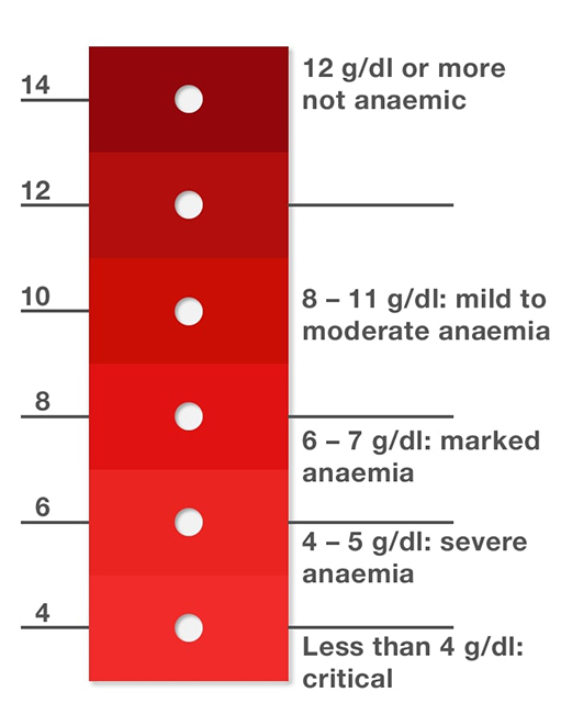 World Health Organization’s hemoglobin color scale