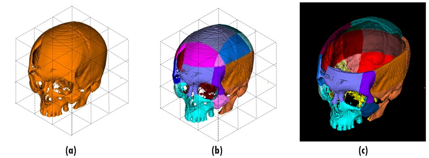 
Cranium puzzle composed of 27 cubic blocks. (a) Image is the DICOM model before cubic blocks division, (b) Image presents the cell division of the cranium, (c) Image is the puzzle generated and imported on the game engine
