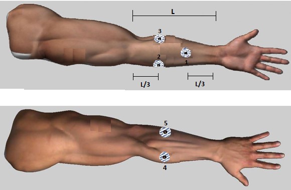 Electrode placement for the acquisition of EMG signals