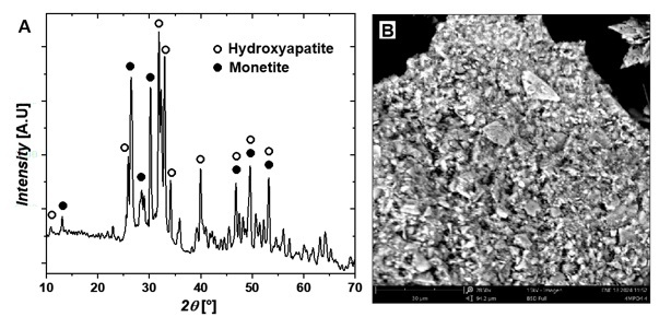 XRD
patterns plot and B. SEM images of the precipitated monetite
and hydroxyapatite at pH 5