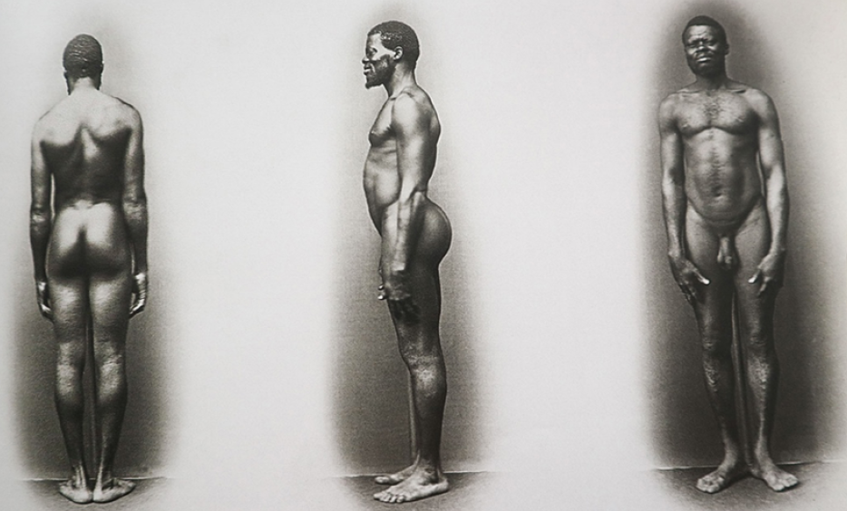 Fotografías antropométricas comisionadas por Louis Agassiz (Stahl, 1865 c.)