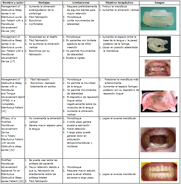 DT News - Latin America - Aparatología de avance mandibular para Apnea del  Sueño (2)