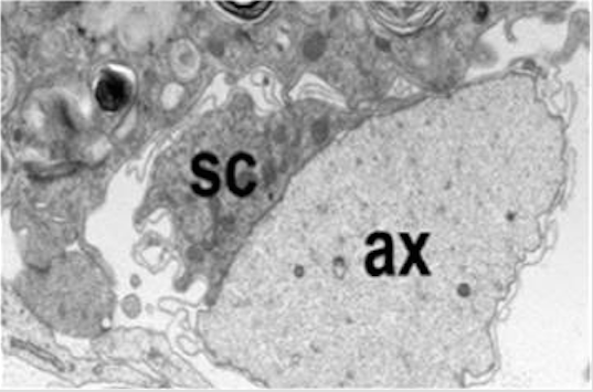 Micrografía electrónica de un nervio sano murino que muestra un axón (ax) y su
célula de Schwann (SC) intactos