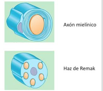 Factores
de transcripción que promueven el estado promielinizante. Las células de Schwann
adquieren asociación uno a uno con el axón (axón mielínico). Otras células de Schwann
permanecen amielínicas agregando múltiples axones (haces de Remak)