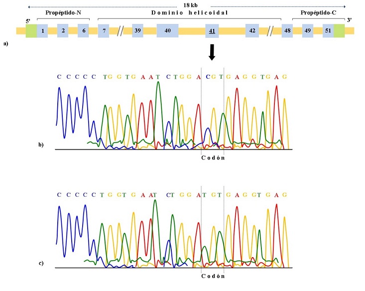a) Representación del exón
41 del gen COL1A1. b) Secuencia del ADN
normal. c) Sitio de transición 3040 C > T en el exón en el gen COL1A1 del paciente IV-11