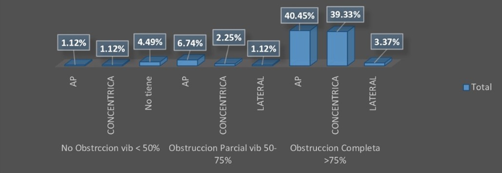 Distribution of the degree and direction of obstruction in the velopharynx