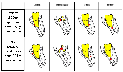 Classification of the position and relationship between the roots of third molars and the IAC as seen on cone beam computed tomography