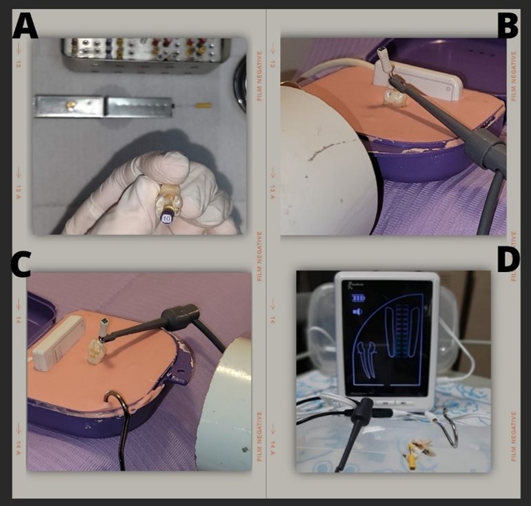 Representative images of the procedure to take the AWL with each of the selected techniques. A) Catheterization with a K10 flexofile. B) and C) Plastic containers with alginate for radiographic measurement. D) Propex II® apical locator.