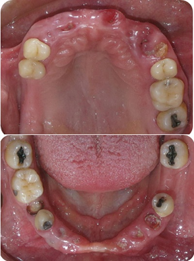 Fotografías
intraorales de los maxilares superior e inferior